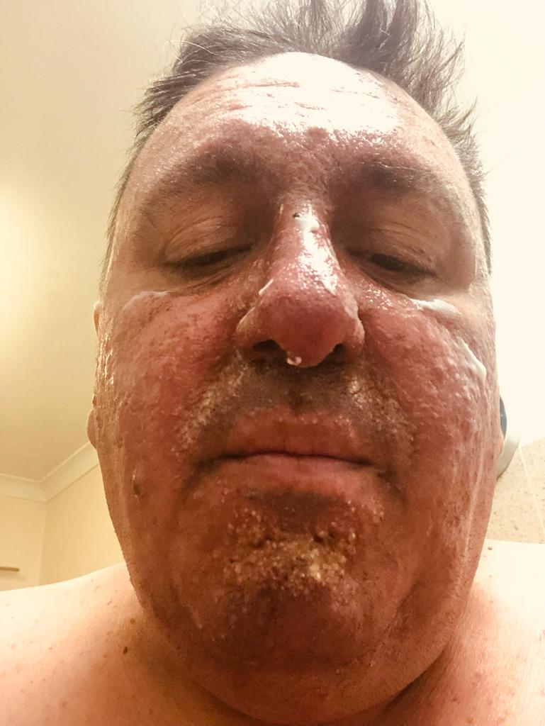 Description of image